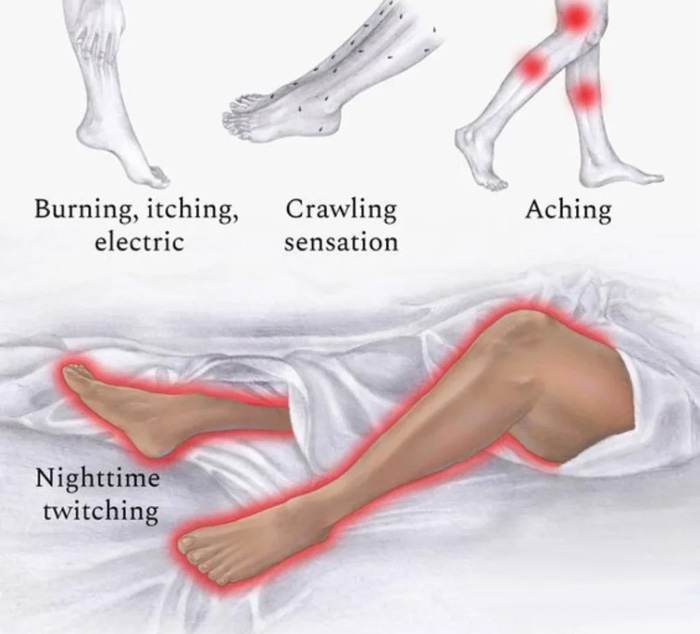 علت پا درد در شب - علائم و راه های درمان