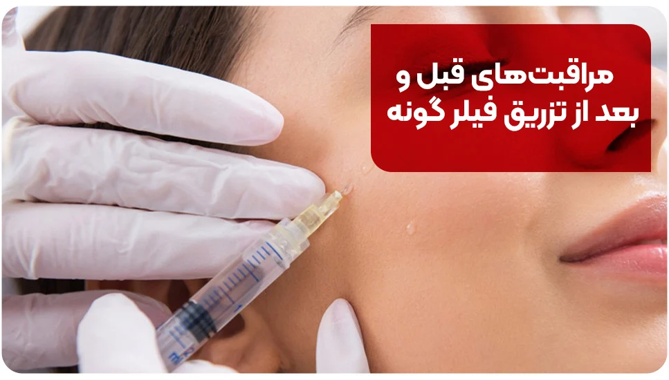 مراقبت‌های قبل و بعد از تزریق فیلر گونه