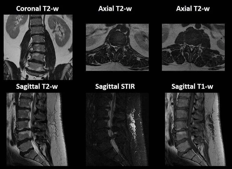 کتاب‌های راهنمای تفسیر سی‌تی‌اسکن و MRI