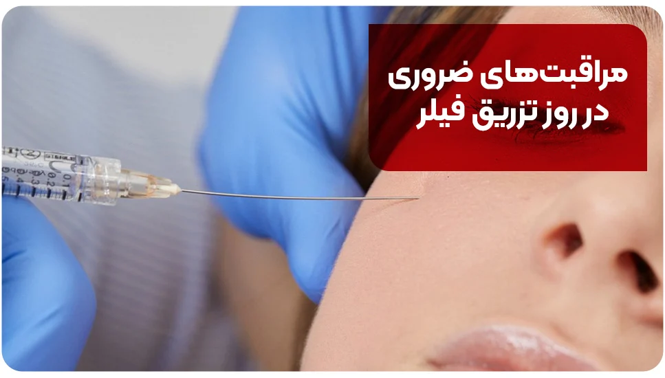 مراقبتهای ضروری در روز تزریق فیلر
